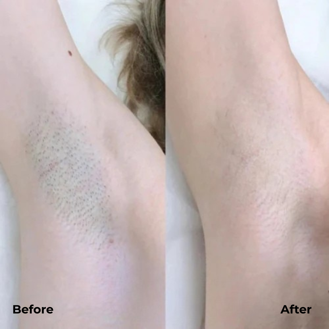 Rasoio doppio di precisione Silktrim™