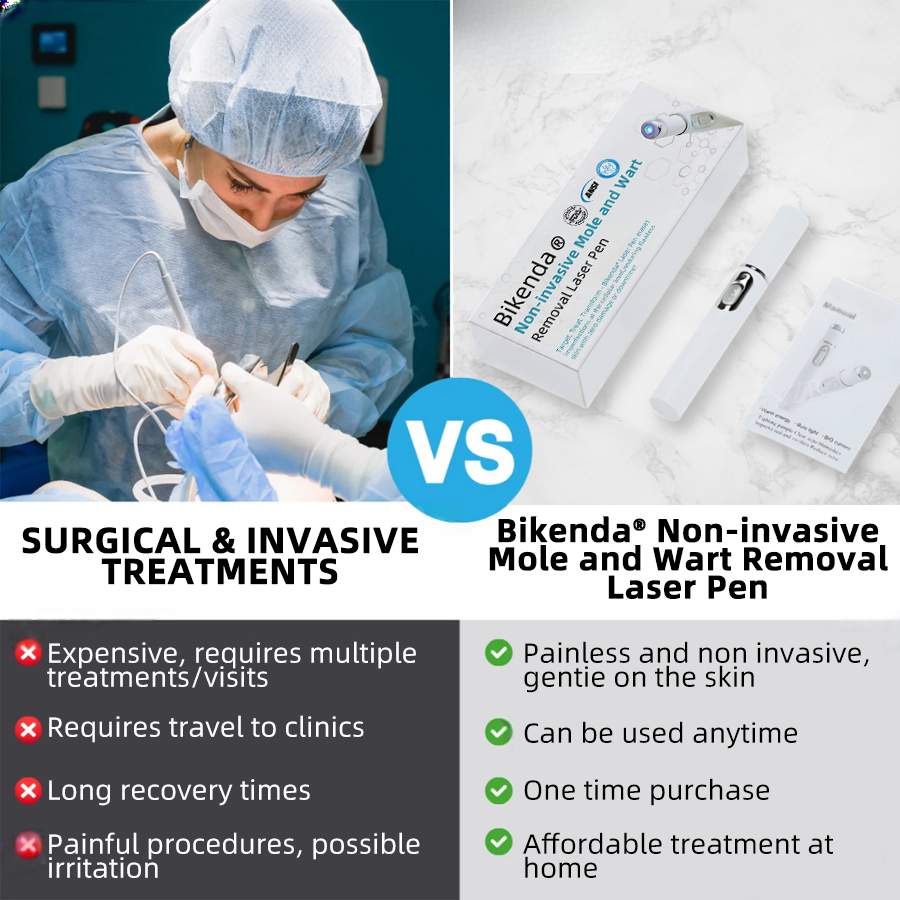 Penna laser Promax per la rimozione non invasiva di nei e verruche