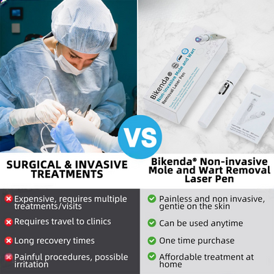 Penna laser Promax per la rimozione non invasiva di nei e verruche