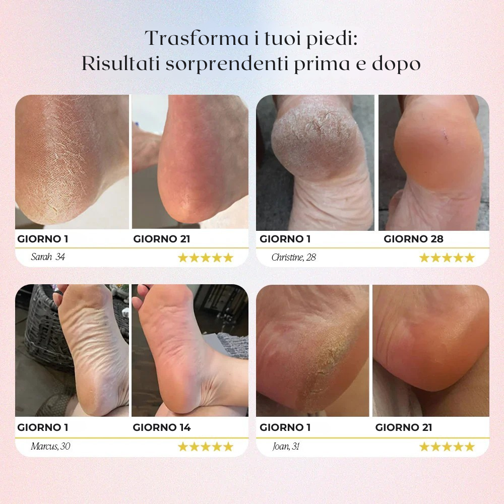 Rimuovi calli elettrico per piedi