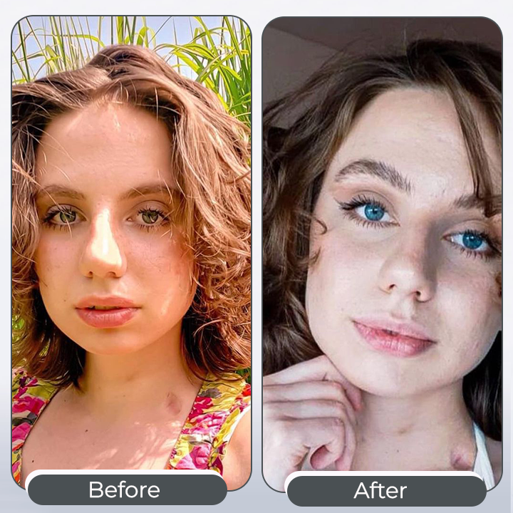 Okikolor™ Collirio per cambiare il colore dell'iride